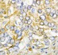 Anti-AIMP2/p38 Antibody